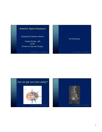 UC  UC  SF  SF  Anterior Spine Exposure  Expanding Treatment Options  No Disclosues  Charles