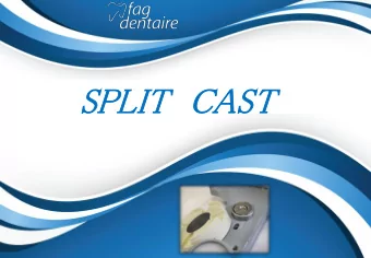 SPL  SPLIT  IT  CA  CAST  ST  Installation of Split Cast Kit Split Cast Kit Rf QM 2000  2 screws