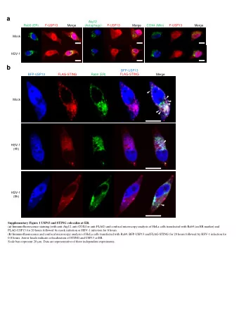 a  Atg12 Rab9 (ER) F-USP13 Merge (Autophagy) F-USP13 Merge COX4 (Mito) F-USP13 Merge Mock HSV-1  b