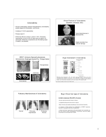 1  Major Clinical Sub-types of Scleroderma  Major Clinical Sub-types of Scleroderma  Scleroderma