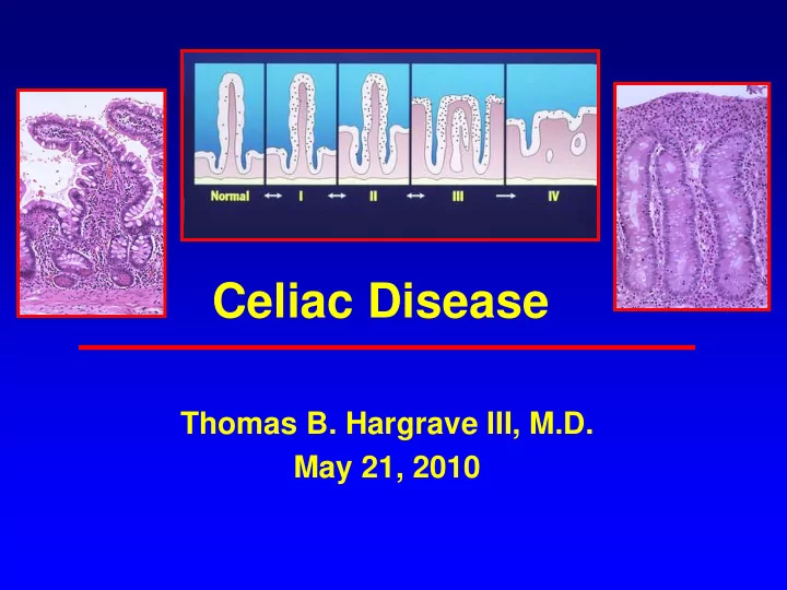 celiac disease