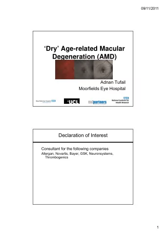 Dry Age-related Macular  Degeneration (AMD)  Adnan Tufail  Moorfields Eye Hospital