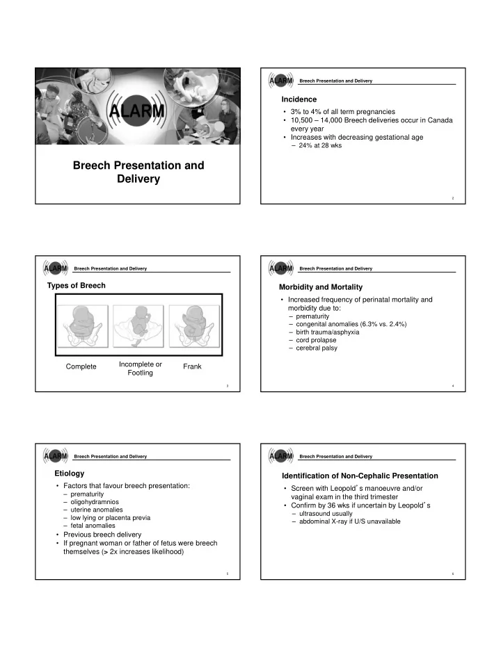 breech presentation and delivery