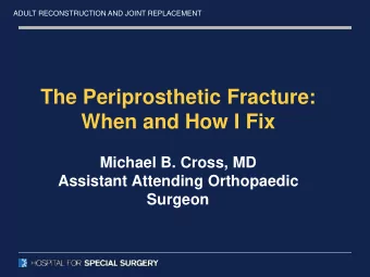 The Periprosthetic Fracture:  When and How I Fix  Michael B. Cross, MD  Assistant Attending